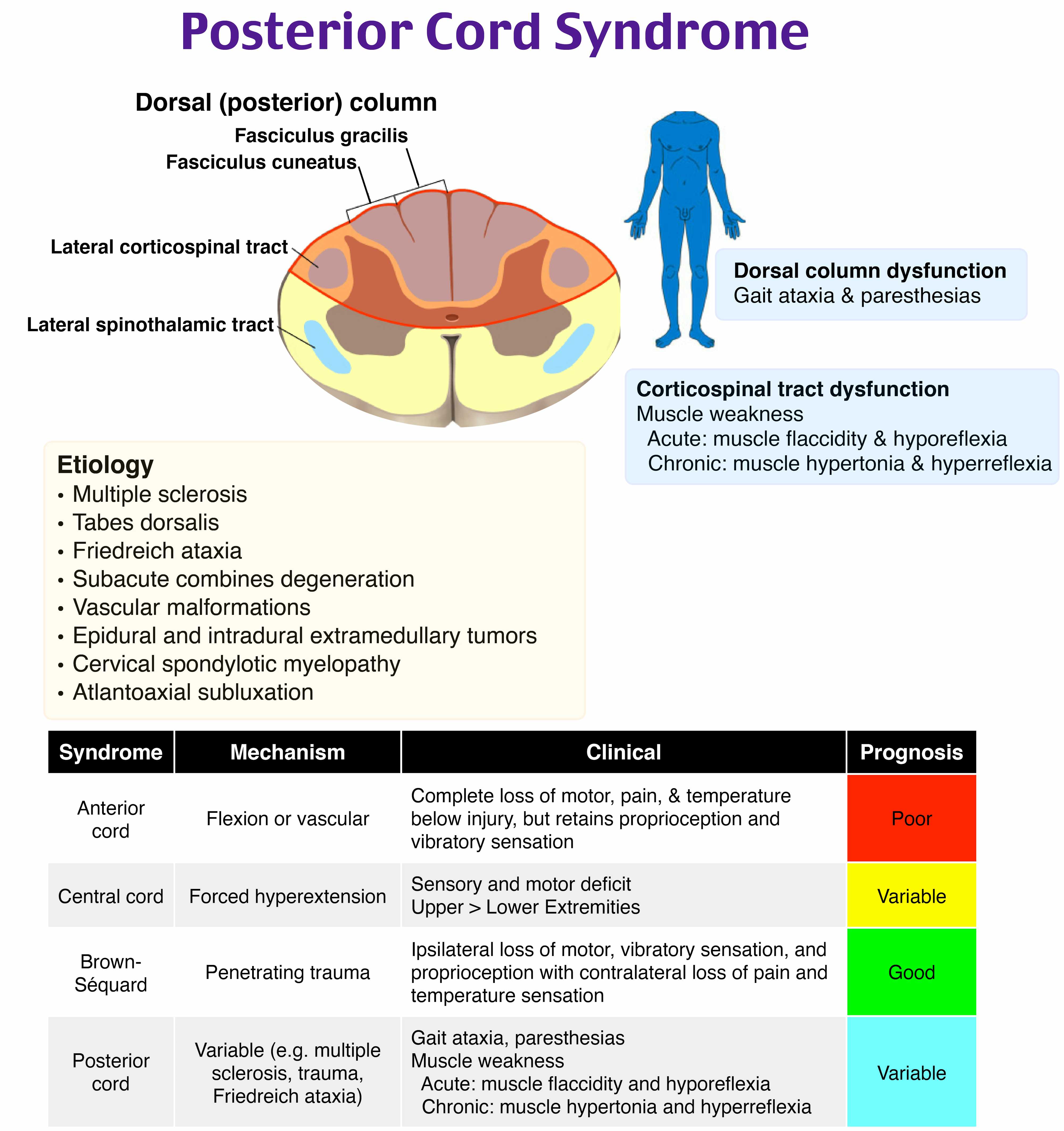 Explosion Injuries Rosh EM@3AM: Thoracic and Lumbar Spine Trauma - emDocs